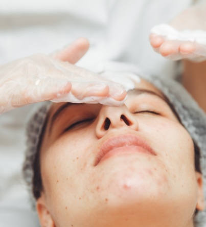 facial skin treatment