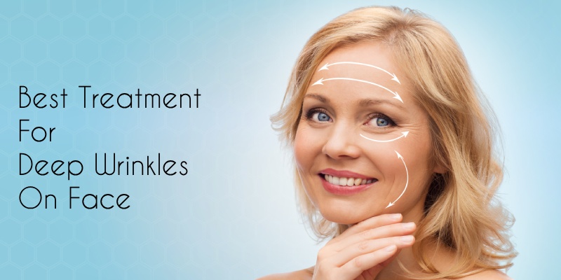 Best Treatment For Deep Wrinkles On Face